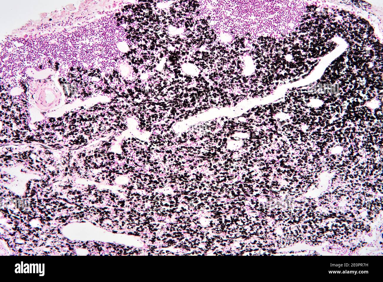 Ganglio linfático (sistema linfático o inmunitario). X75 a 10 cm de ancho. Foto de stock