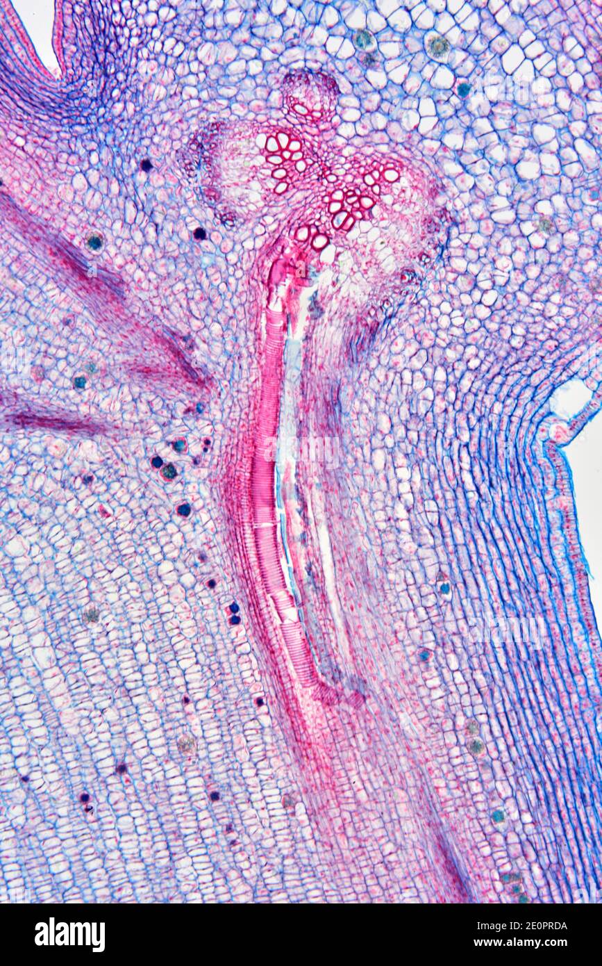 Nódulo de un tallo de planta vascular con xilema espiral (tejido de transporte). Fotomicrografía X50 a 10 cm de ancho. Foto de stock
