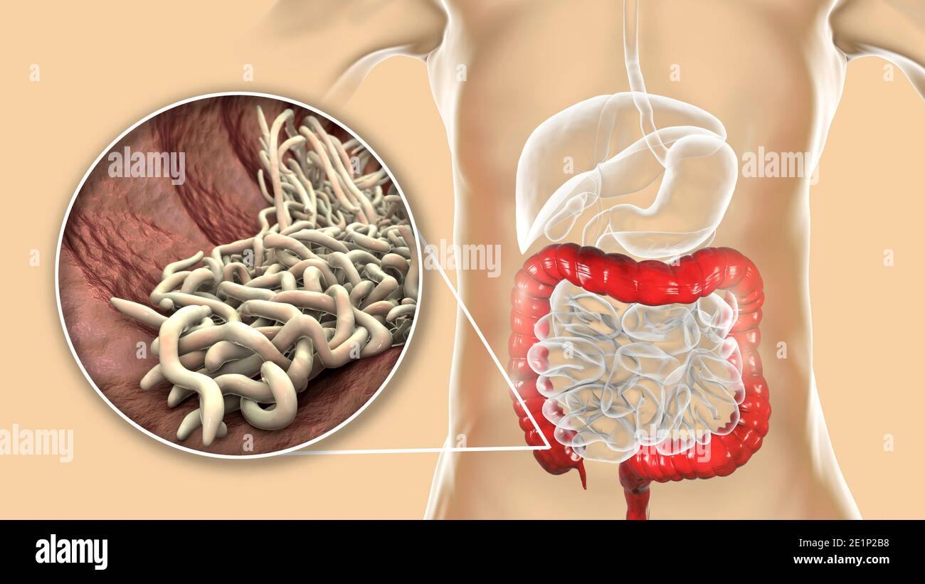 Lombriz intestinal humana fotografías e imágenes de alta resolución - Alamy