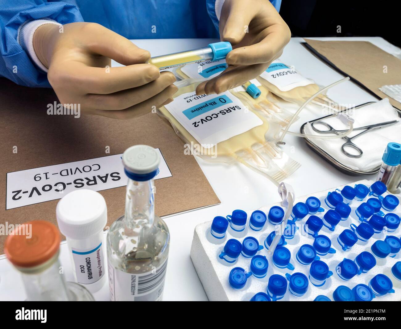 Bolsa de plasma con anticuerpos de personas curadas de SARS-COV-2 Covid-19 preparada en un hospital, imagen conceptual Foto de stock