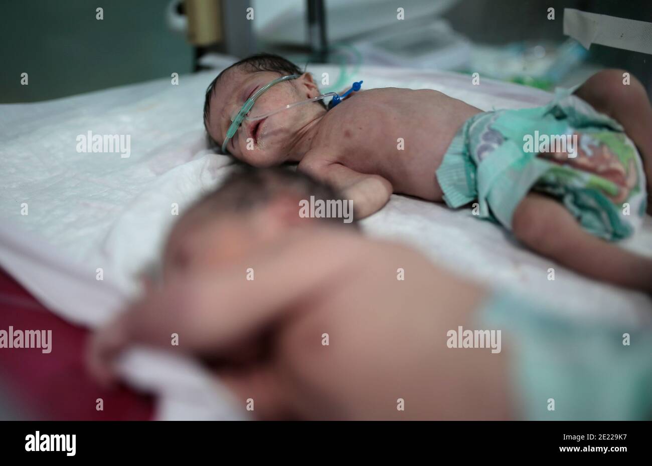 Sanaa, Yemen. 11 de enero de 2021. Dos recién nacidos malnutridos yacen en una cama de hospital mientras reciben tratamiento en el Hospital Internacional Unimax. Crédito: Hani al-ANSI/dpa/Alamy Live News Foto de stock