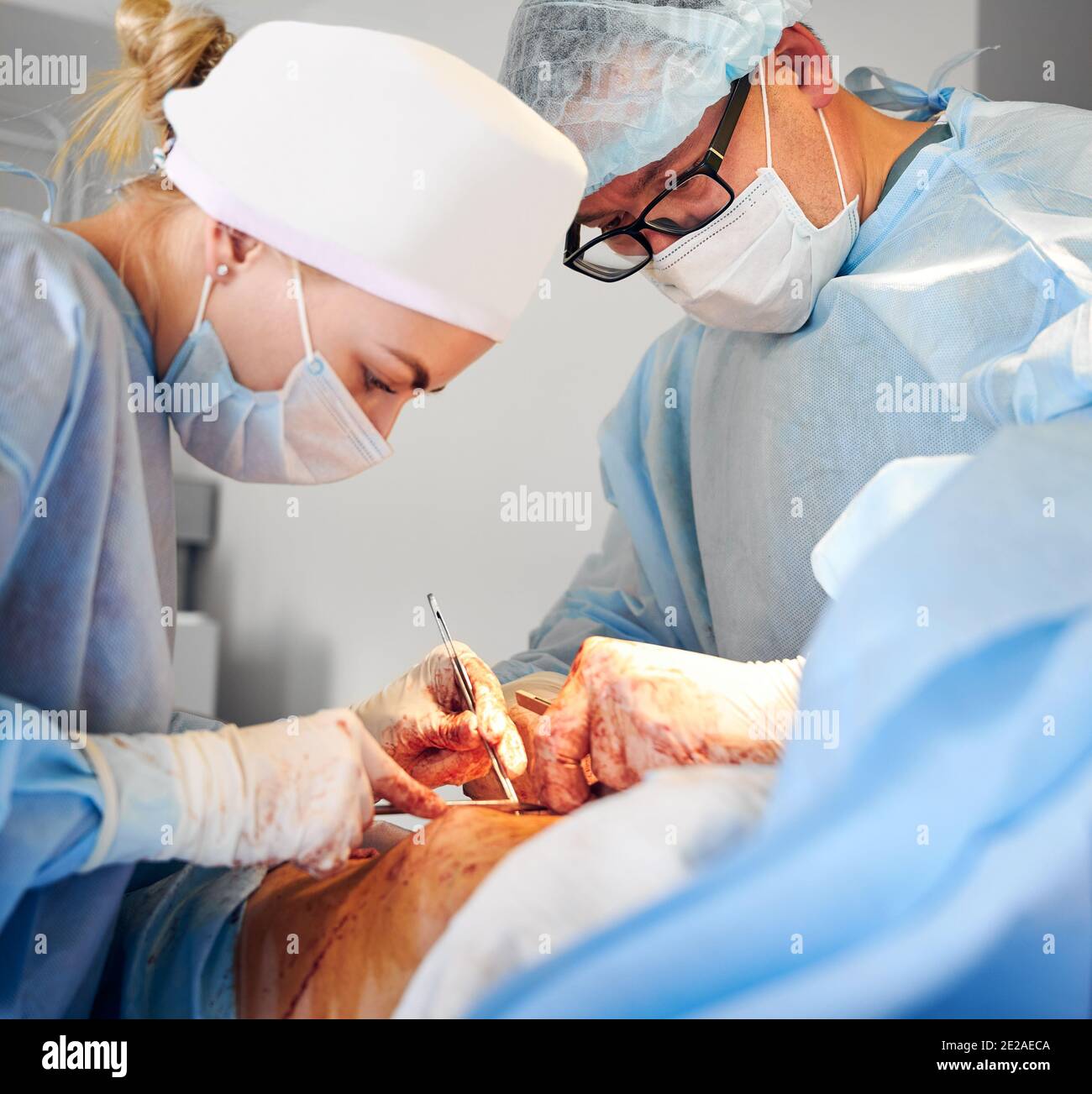 Médicos que realizan cirugía de abdominoplastia en el hospital. Foco en