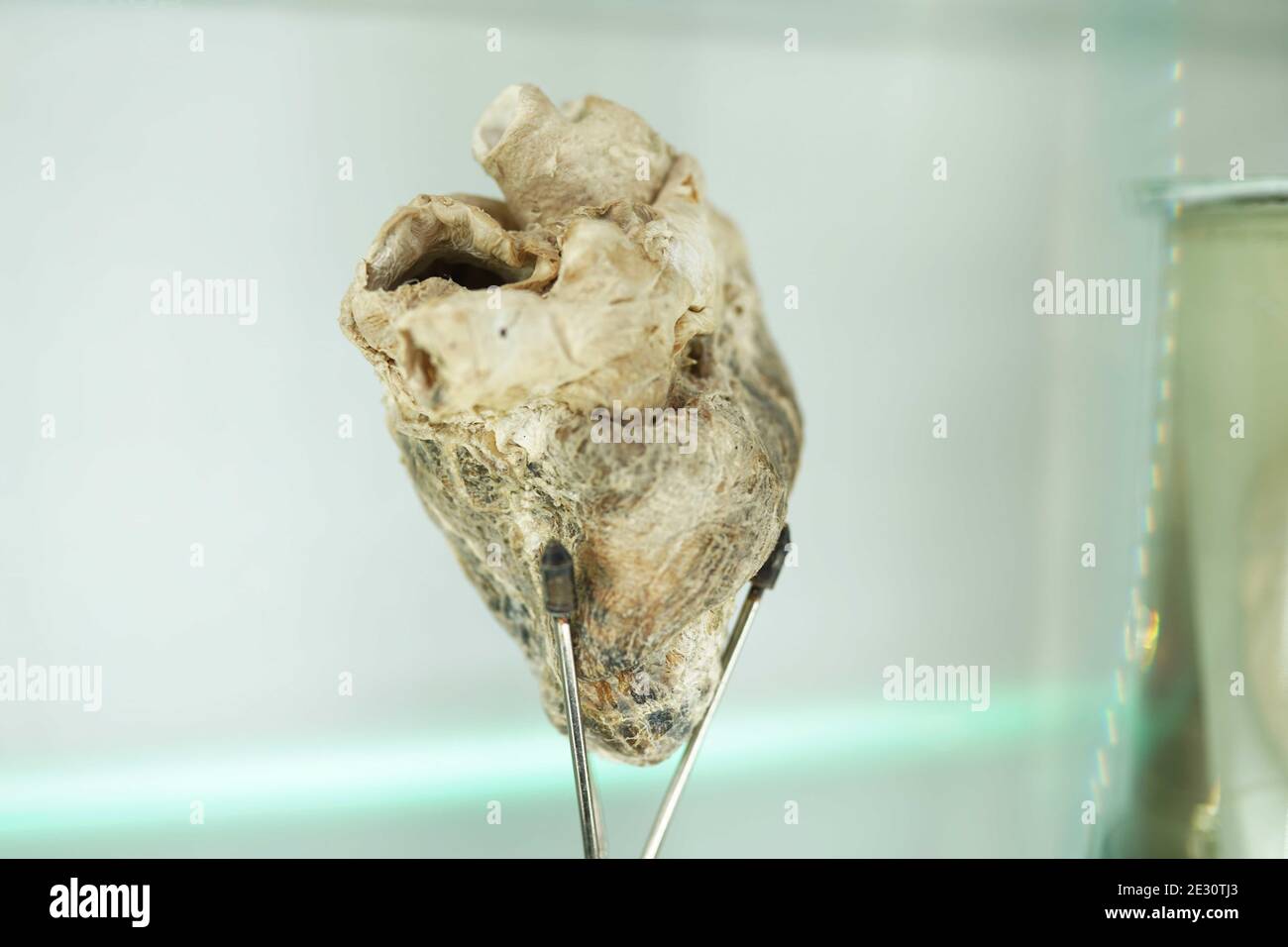 Corazón Anatomía del órgano humano. Parte del cuerpo humano. Concepto de ciencia médica Foto de stock