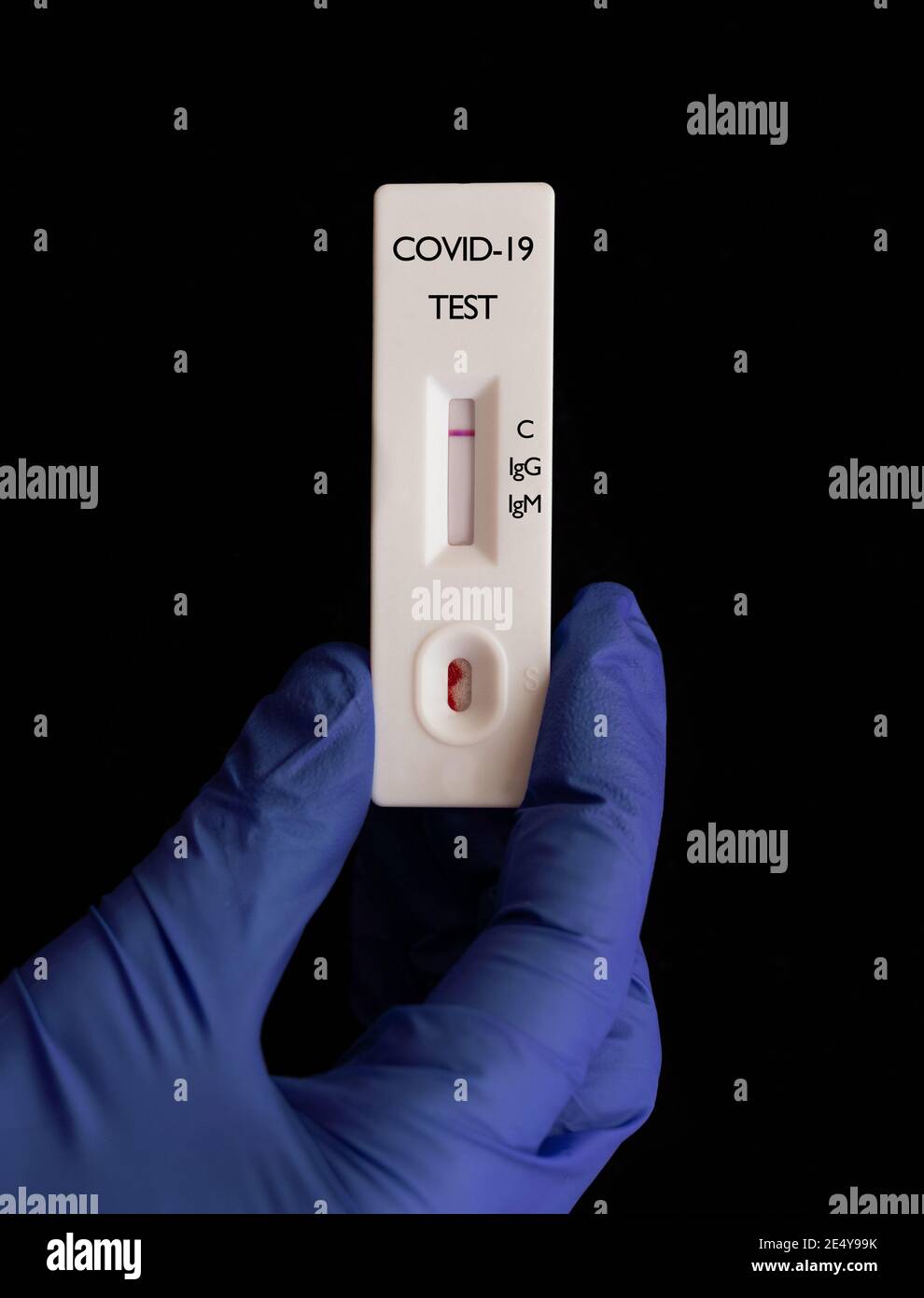 Prueba serológica rápida negativa (anticuerpos IgG/IgM) Para COVID-19 (SARS-CoV-2) en manos de un médico con guantes azules Foto de stock