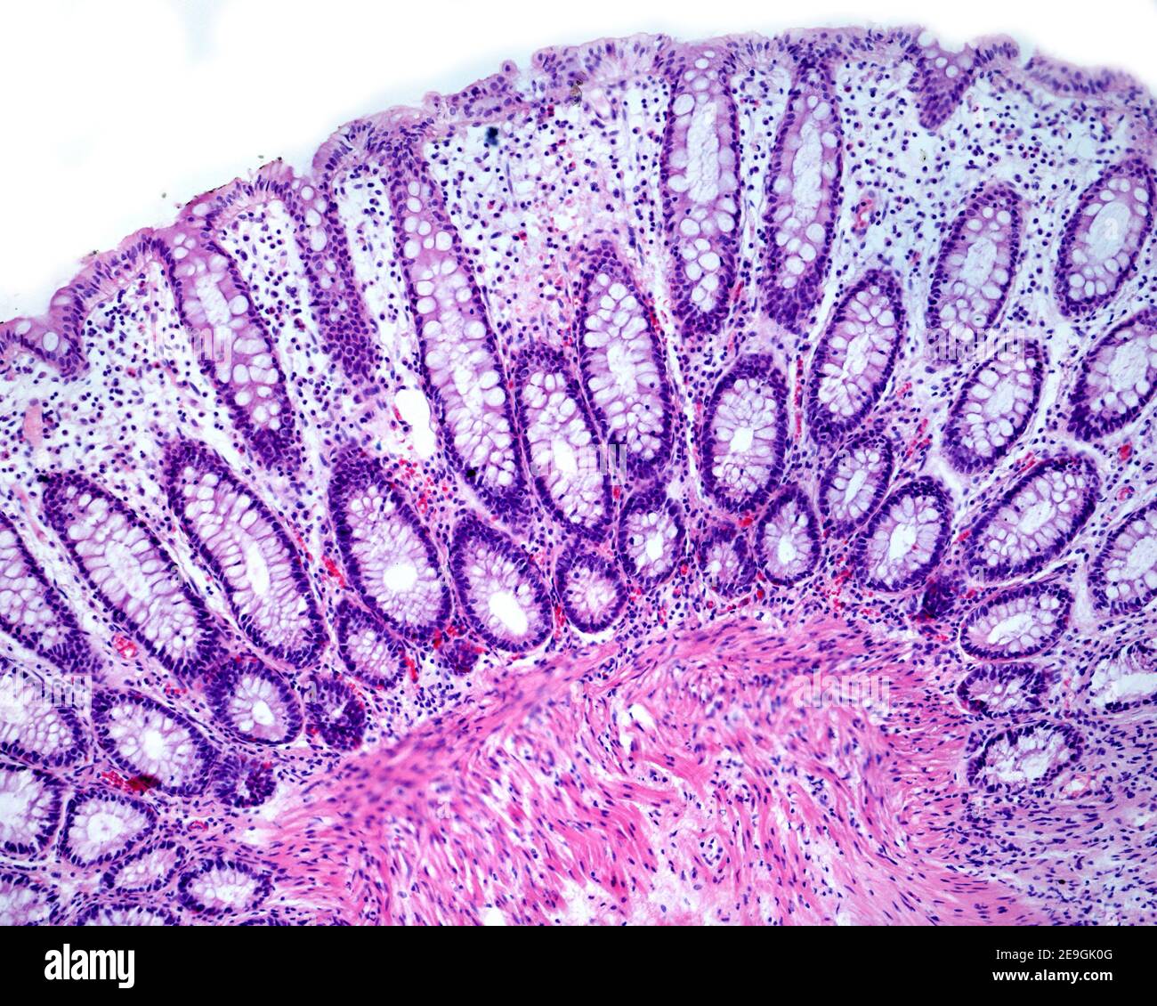 Lieberkühn criptas de una mucosa humana del colon que muestran abundantes células de los goblet del citoplasma pálido. Foto de stock