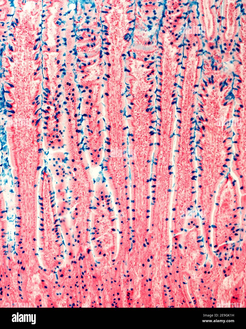 Mucosa del intestino delgado teñida con la técnica de hierro coloidal  Muller-Mowry. Las células de los goblet aparecen como puntos azules en el  epitelio que recubre el Fotografía de stock - Alamy