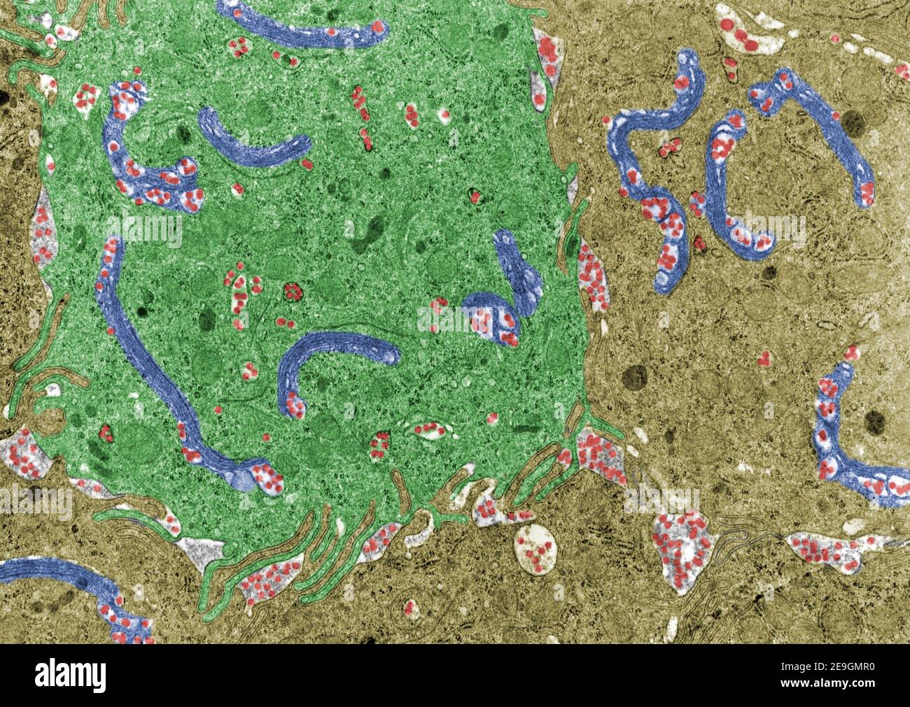 Micrografía de microscopio electrónico de color falso que muestra quilomicrones (rojo) en los enterocitos del intestino delgado. Aparecen en el aparato de Golgi (rosa) an Foto de stock