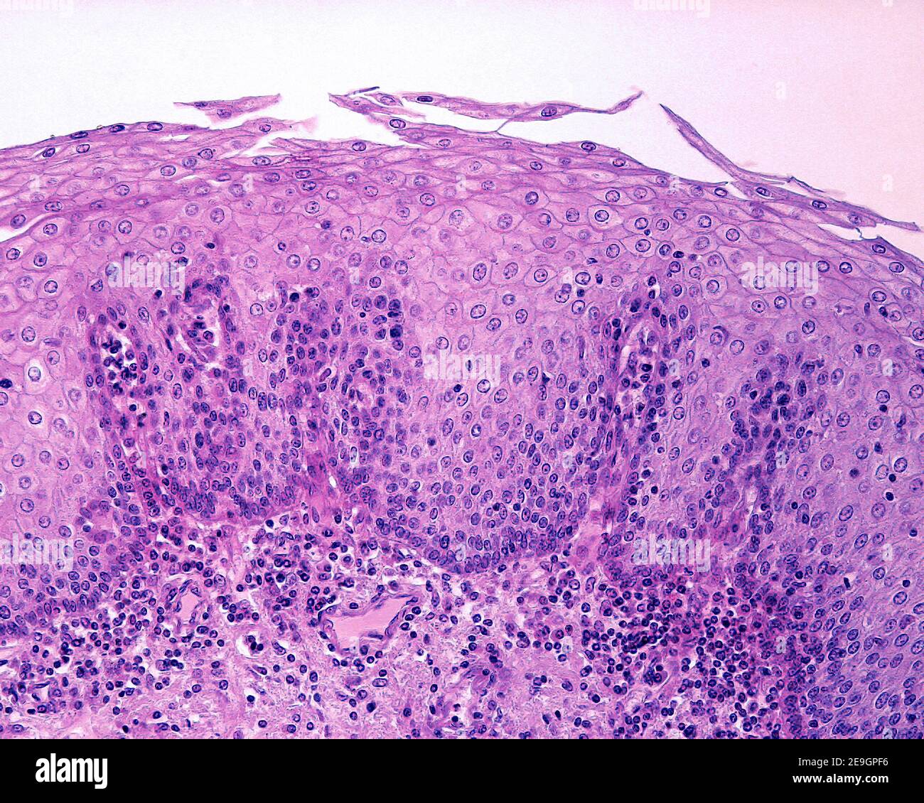 Revestimiento epitelial del esófago. Es un epitelio escamoso estratificado no queratinizado, cuyas células más superficiales retienen sus núcleos Foto de stock