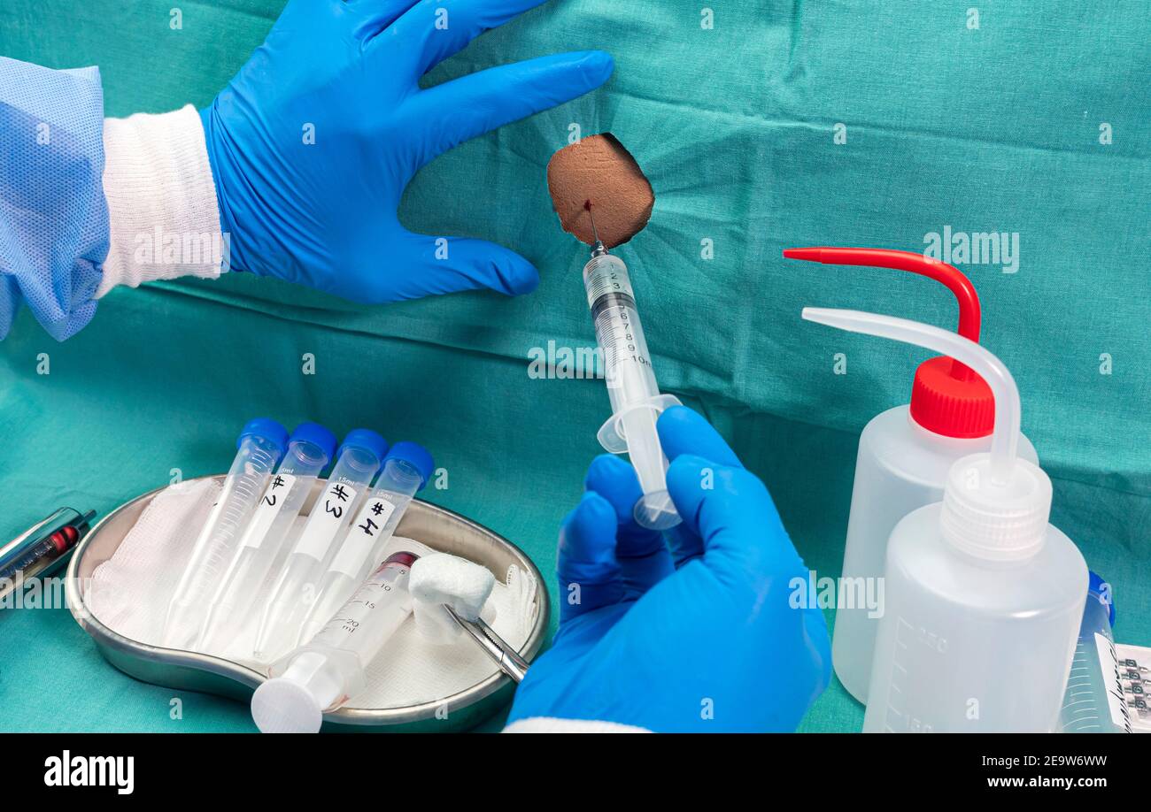 Histología De Las Granulaciones Aracnoideas