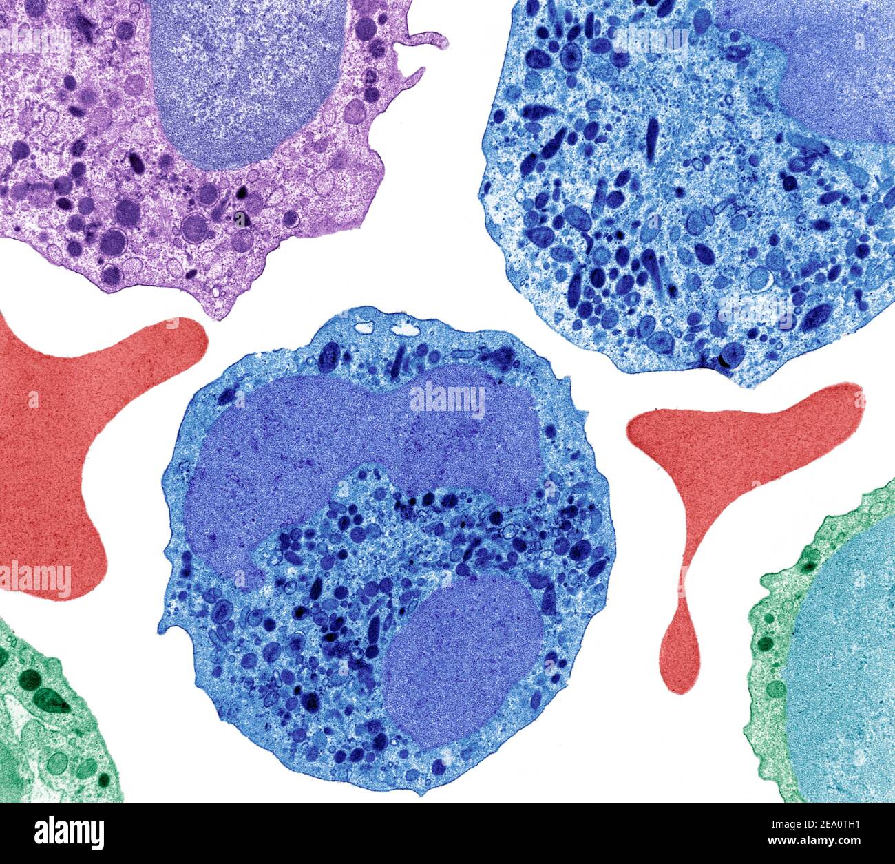 Neutrófilo microscopio fotografías e imágenes de alta resolución - Alamy