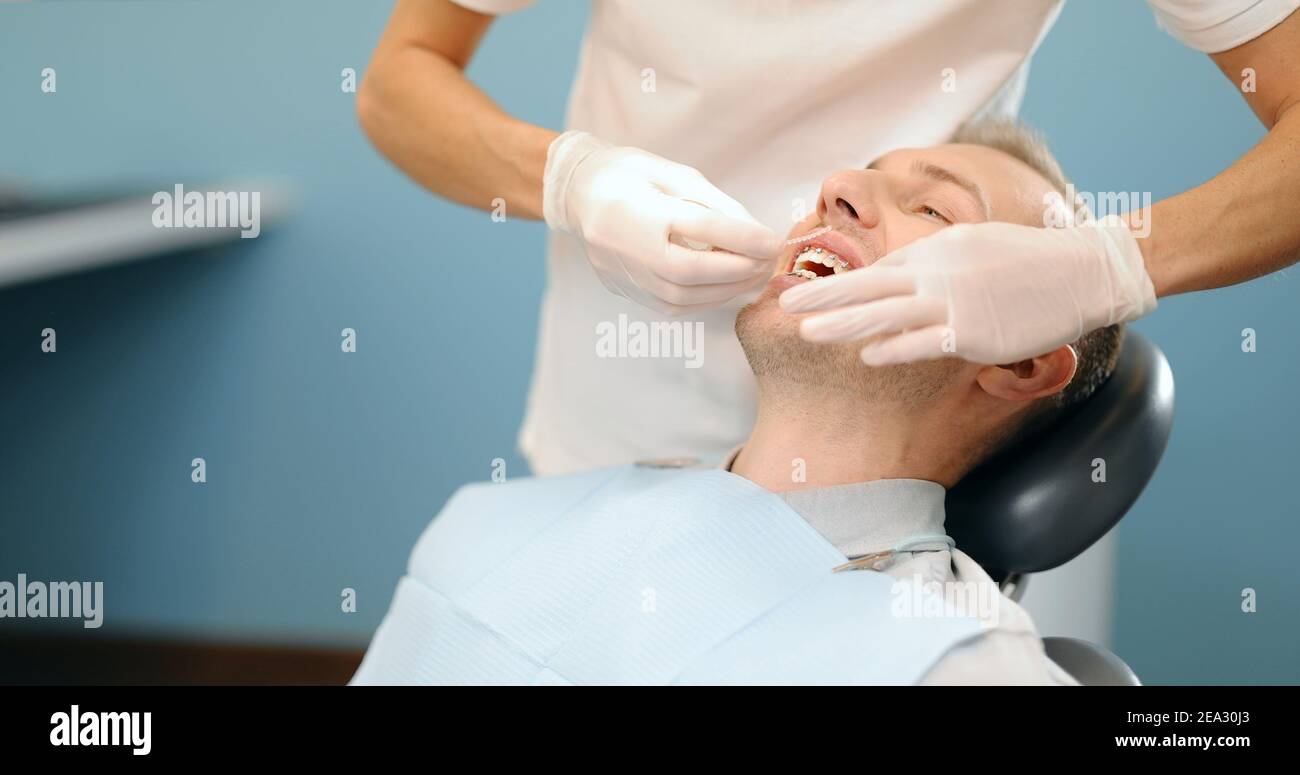 Ortodoncista que reemplaza ligaduras en aparatos dentales en el consultorio dental Foto de stock