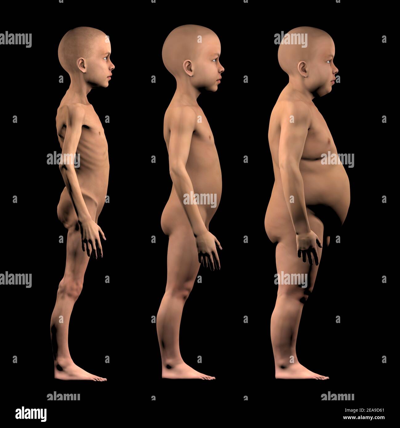 Niños obesos fotografías e imágenes de alta resolución - Alamy