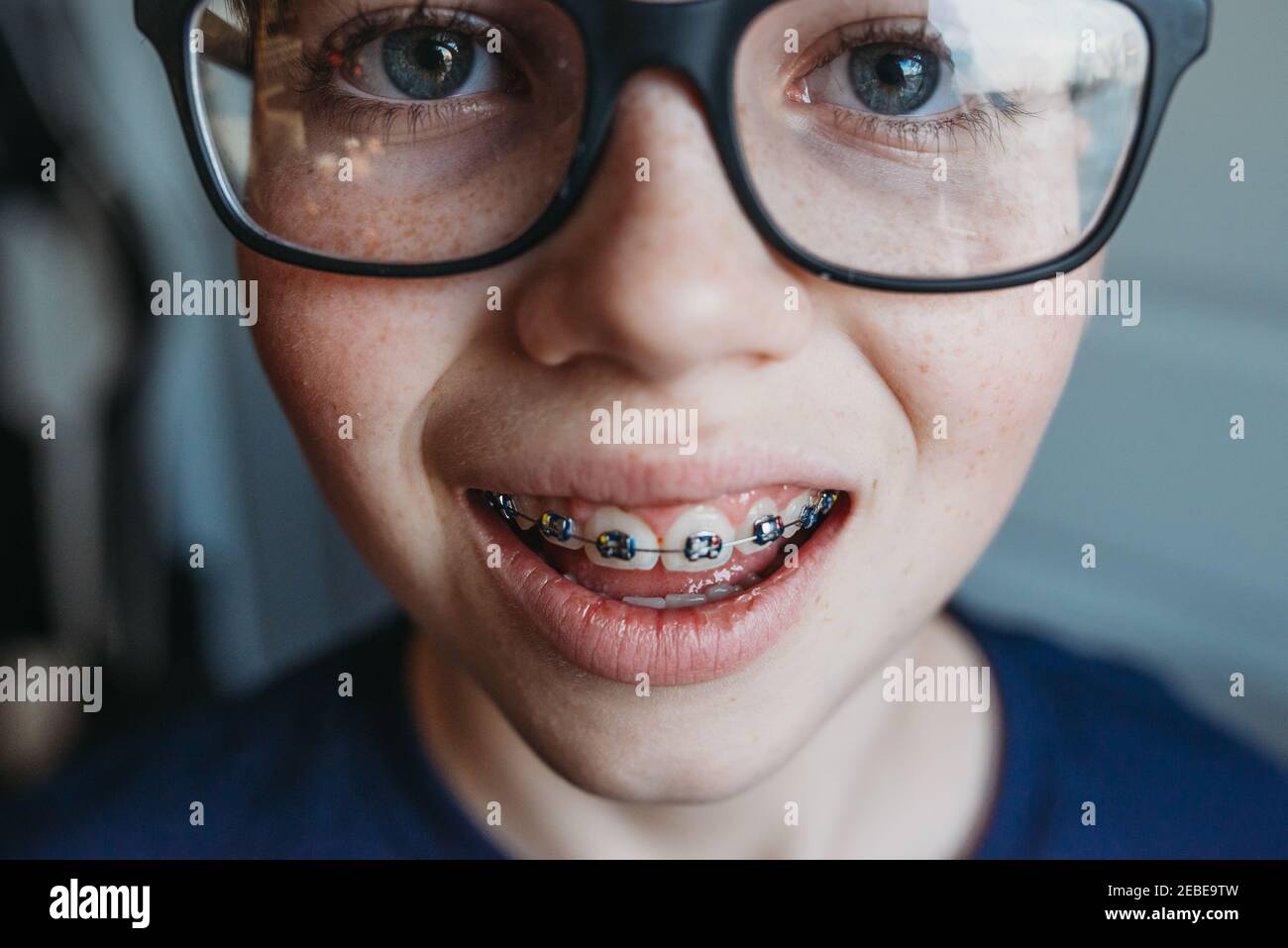 Primer plano de un joven adolescente con gafas y aparatos ortopédicos  Fotografía de stock - Alamy