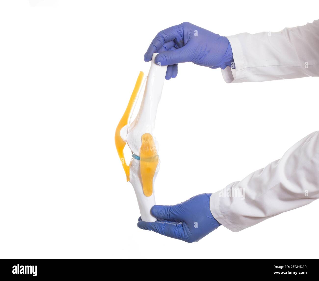 El médico traumatólogo sostiene un modelo de articulación de la rodilla