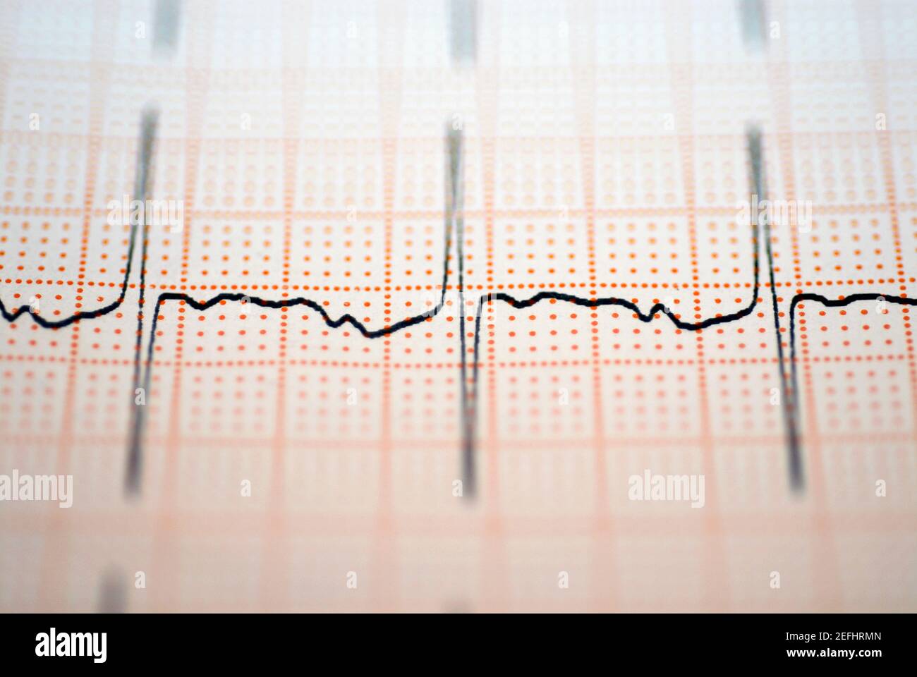 Close-up de un informe de ECG Foto de stock