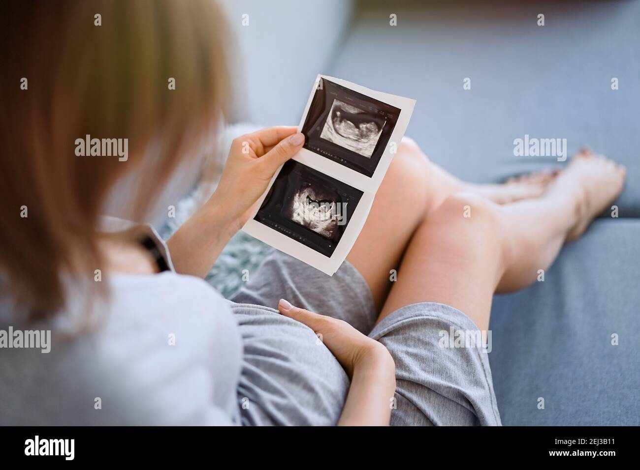 Pregnancy ultrasound fotografías e imágenes de alta resolución - Página 9 -  Alamy
