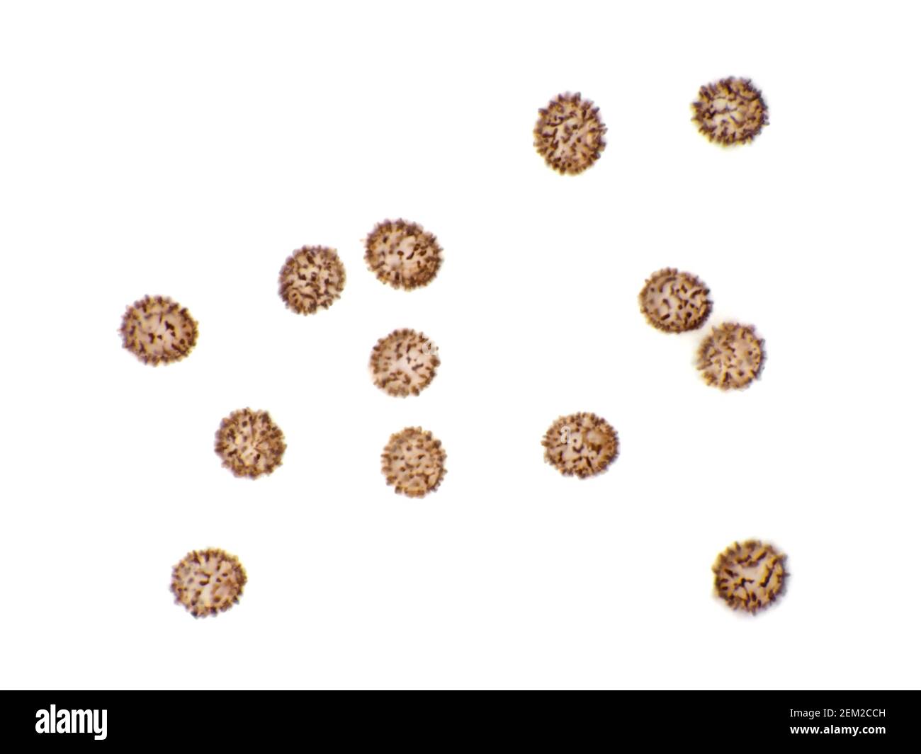 Esporas de russula (Russula brevipes) de tallo corto (teñidas con yodo) bajo el microscopio, el campo de visión horizontal es de aproximadamente 115 micrones Foto de stock