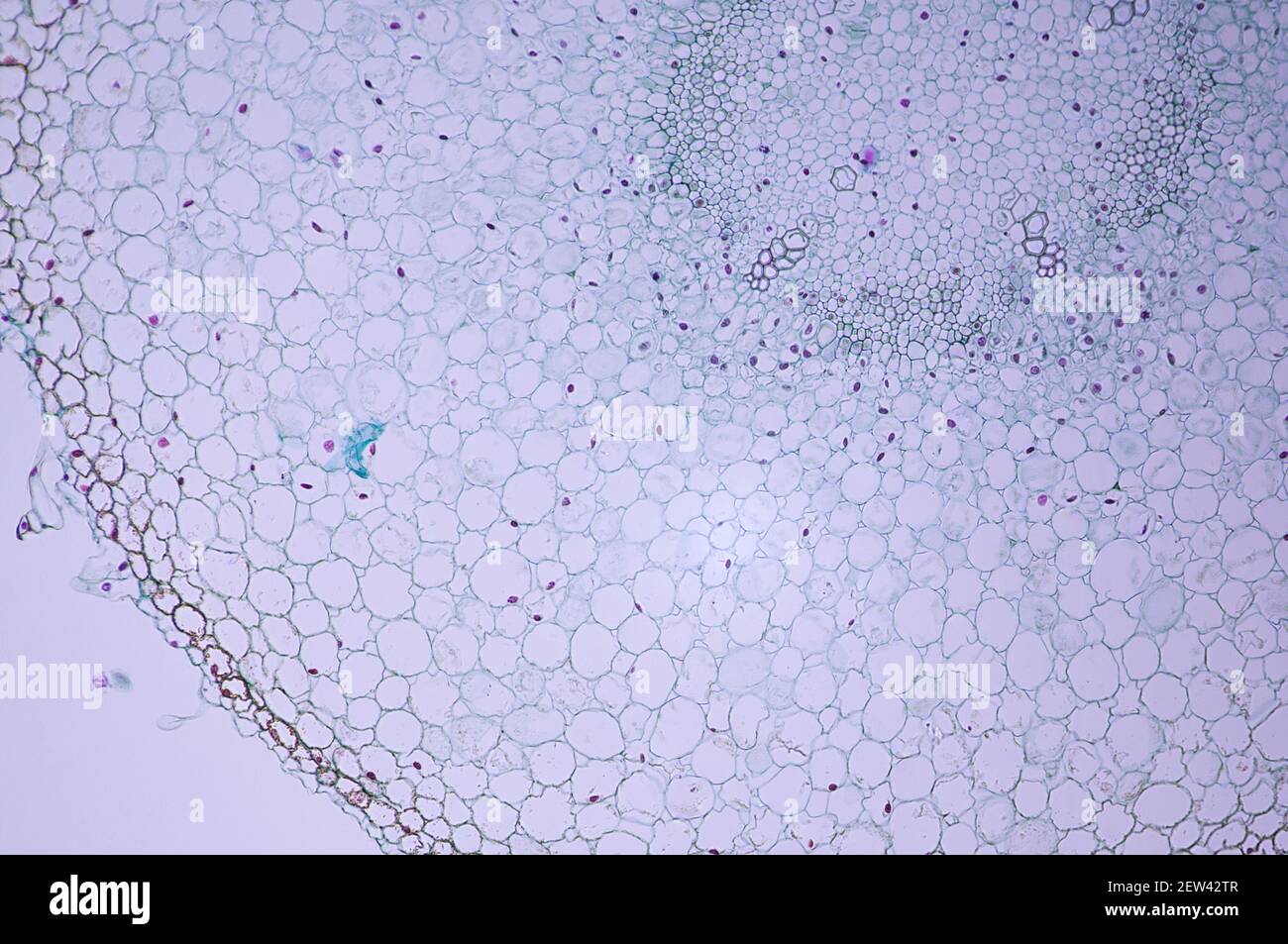 Diez veces la ampliación de las células de raíz del cabello bajo una luz microscopio Foto de stock