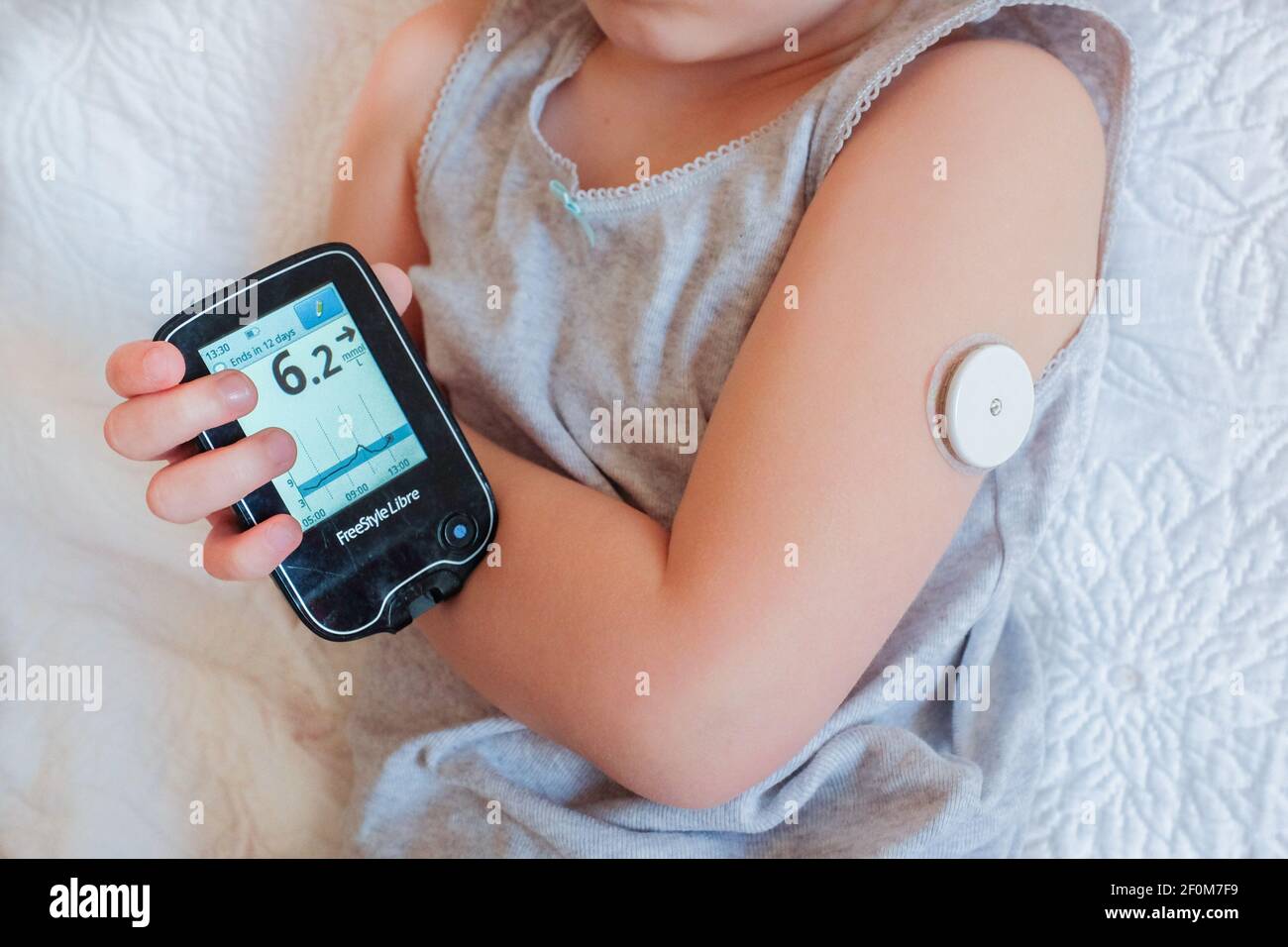 Un niño revisa su azúcar en la sangre escaneando un sensor de glucosa Flash  Freestyle libre. El dispositivo generalmente usado en la parte superior del  brazo ayuda a las personas con diabetes