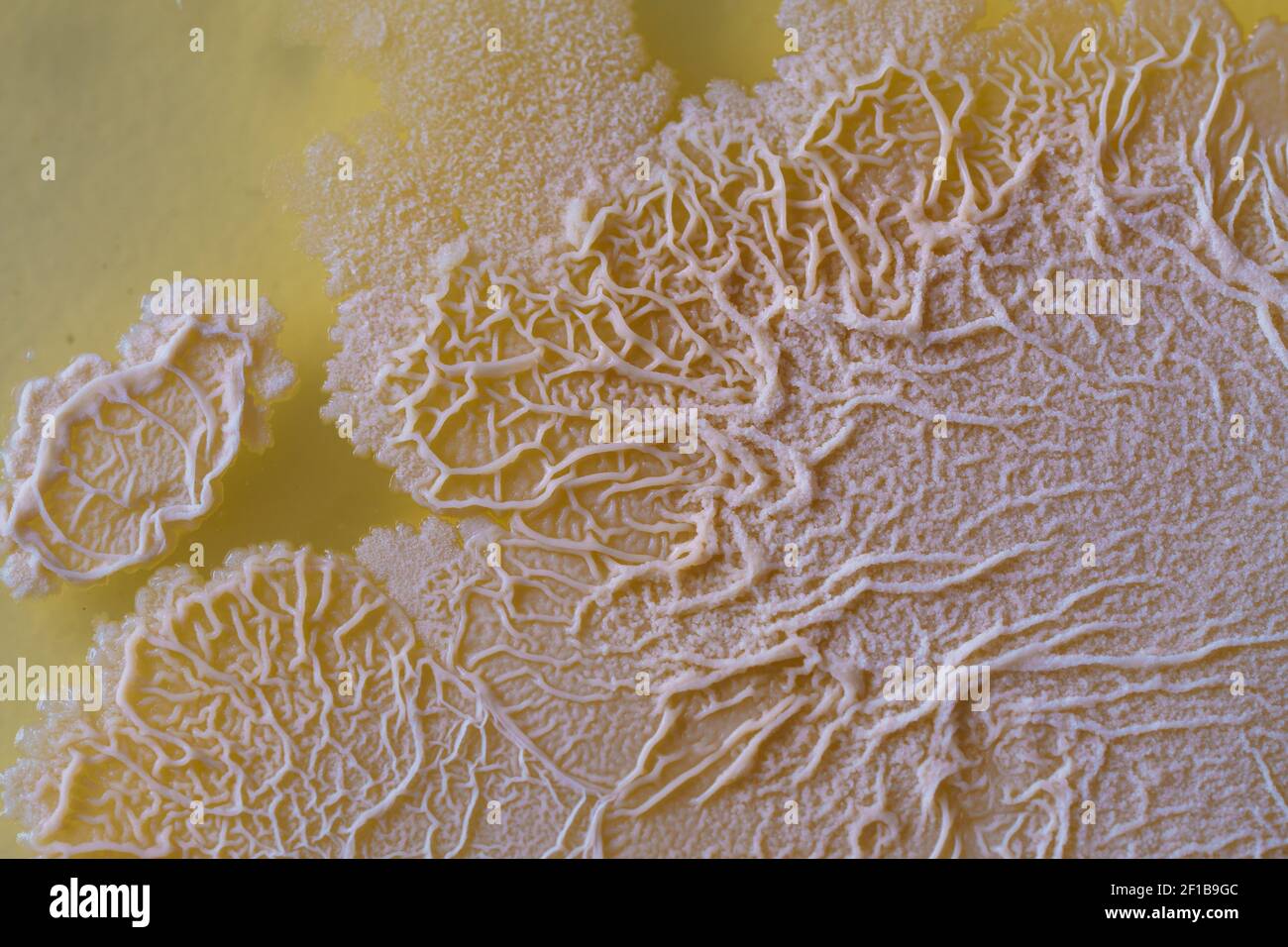 Fotografía de la placa de Petri culturas crecientes colonias mixtas de la  bacteria Escherichia coli (mayor, rosa) y Proteus vulgaris (pequeños,  marrón). Bajo ninguna Fotografía de stock - Alamy