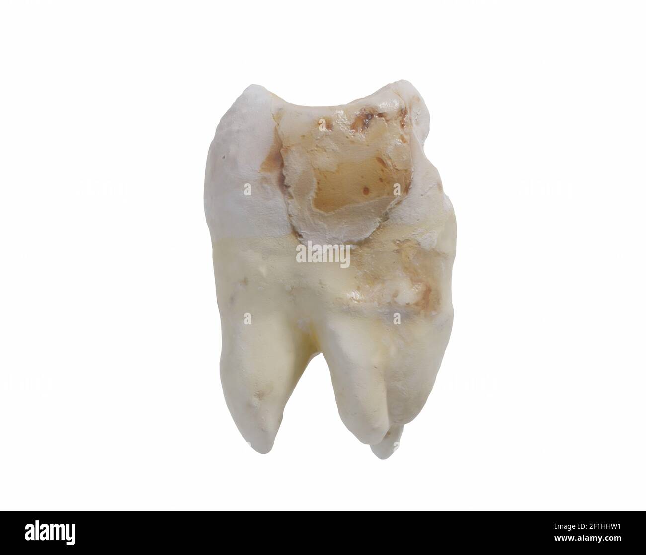 Concepto dental, espejo de boca y diente, 3D ilustración Foto de stock