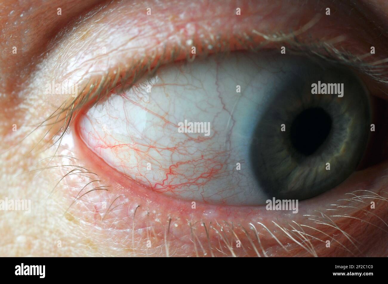 Ojo de hombre con lentes de contacto y capilares sanguíneos. Disparo macro  Fotografía de stock - Alamy