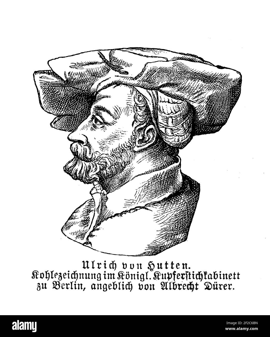Retrato de Ulrich von Hutten ( 1488 - 1523), satírico, poeta, humanista, caballero imperial y partidario de Lutero, grabado por Albrecht Duerer. Foto de stock