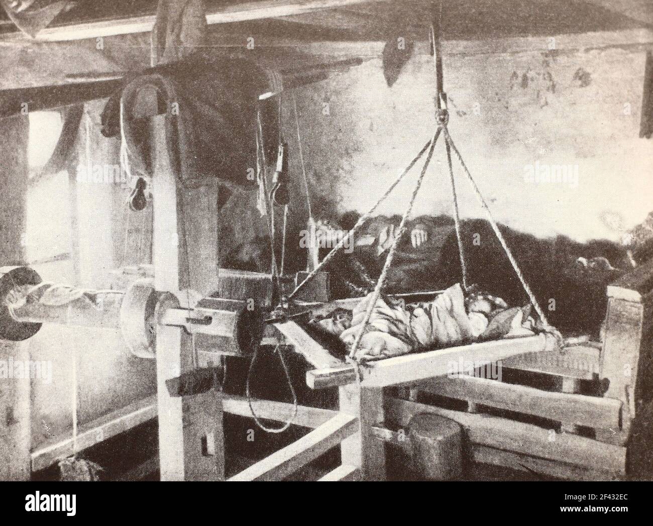 Pacientes con tifus en Rusia en 1894. Foto de stock