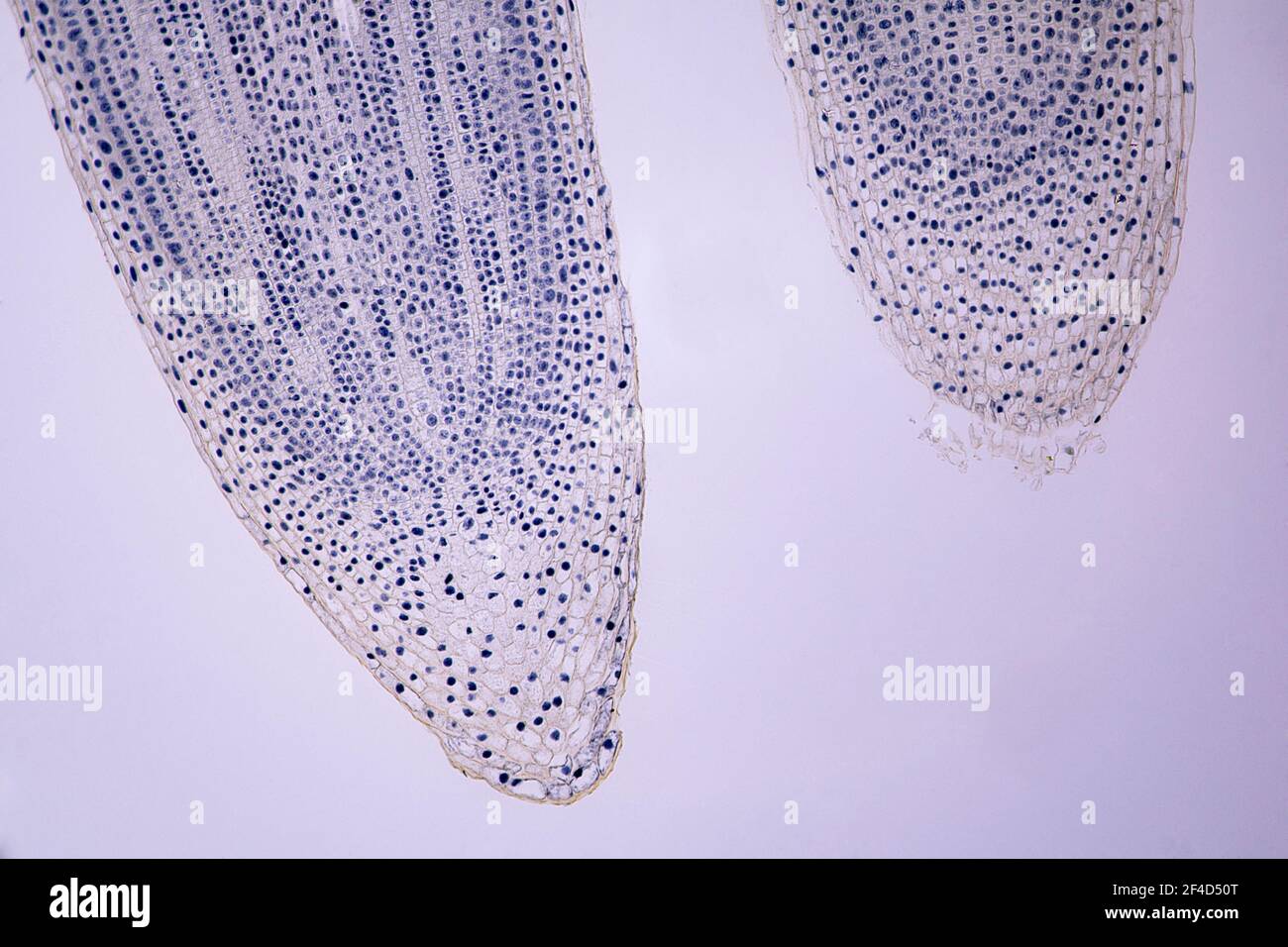 Mitosis en una sección longitudinal de la punta de la raíz de Allium bajo un microscopio de luz a 10 veces de aumento. Foto de stock