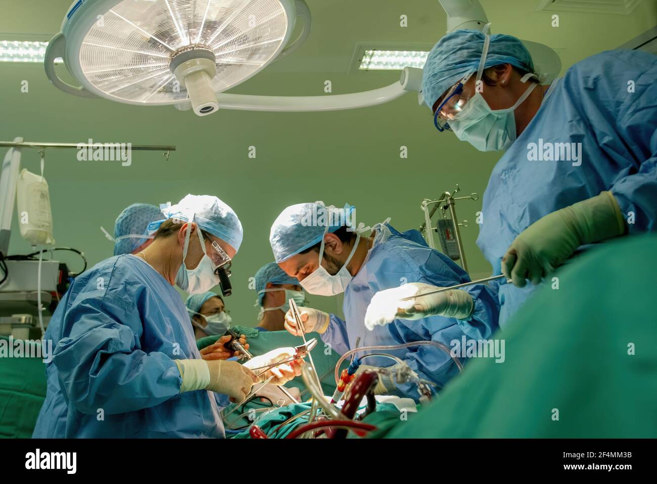 Cardiólogo consultor Ciro Campanella (con óptica), y su equipo, realizando cirugía cardíaca en Edinburgh Royal Infirmary, Edimburgo, Escocia Foto de stock