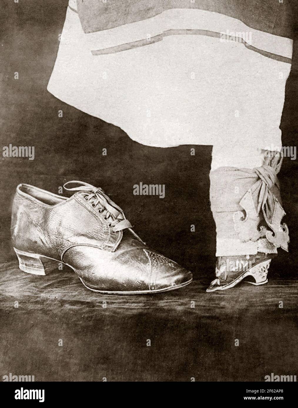 Calzado femenino normal vs. Pie atado, 1918 Foto de stock