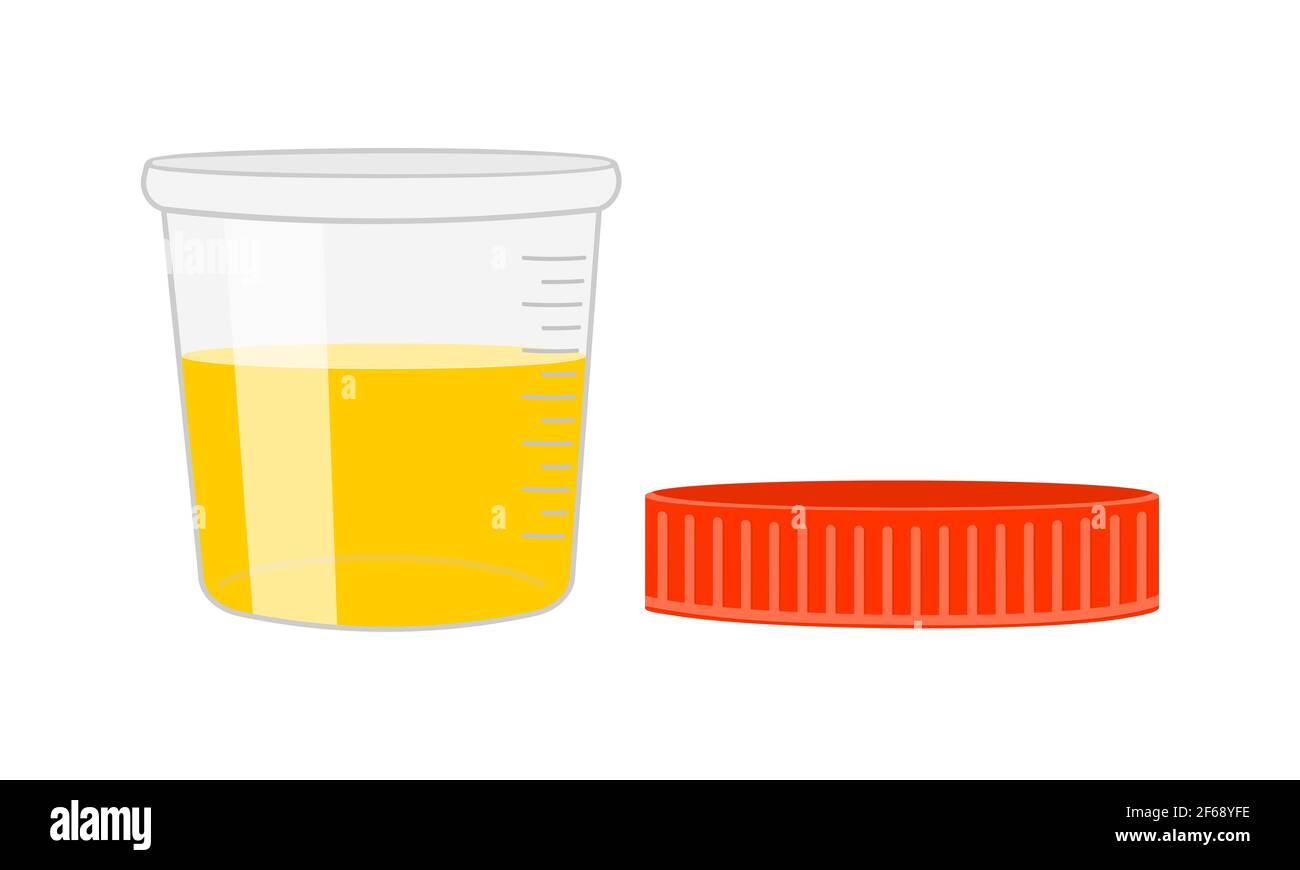 Análisis de orina. Muestra de orina, recipiente de plástico completamente  abierto con cubierta retirada. Concepto de diagnóstico y examen de  laboratorio. Ilustración de dibujos animados vectoriales Imagen Vector de  stock - Alamy