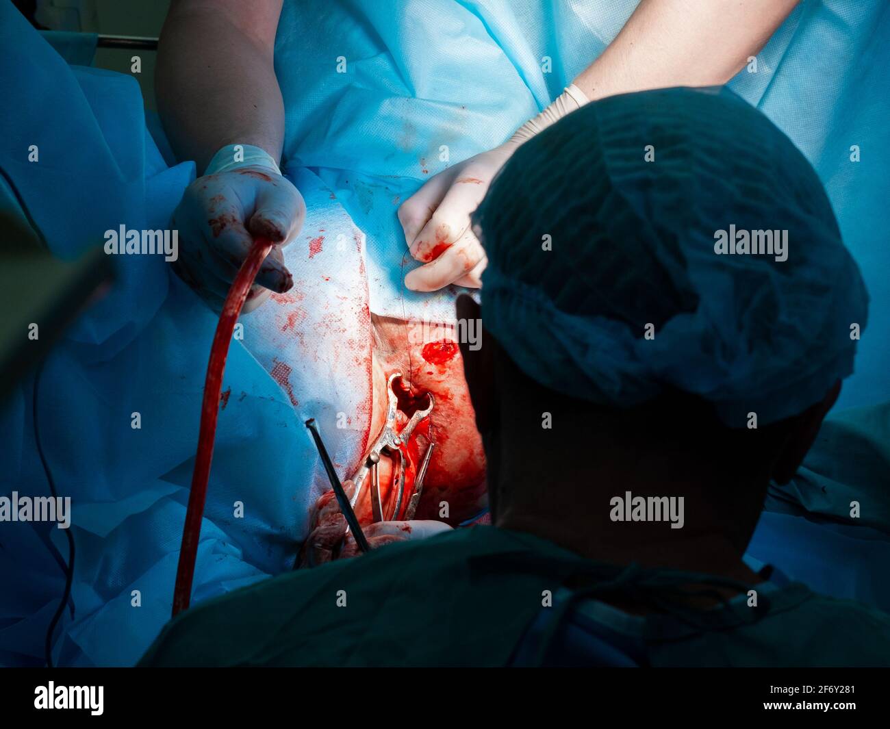 Bisturí quirúrgico Imágenes recortadas de stock - Alamy