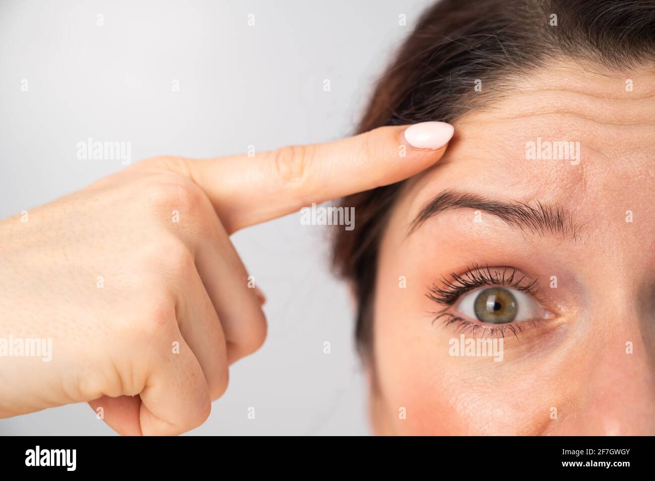 Retrato de cerca de una mujer caucásica de mediana edad que muestra arrugas en su frente. Signos de envejecimiento en la cara Foto de stock