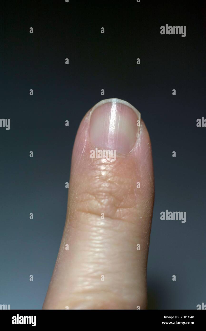 Vista de primer plano de un dedo índice Foto de stock