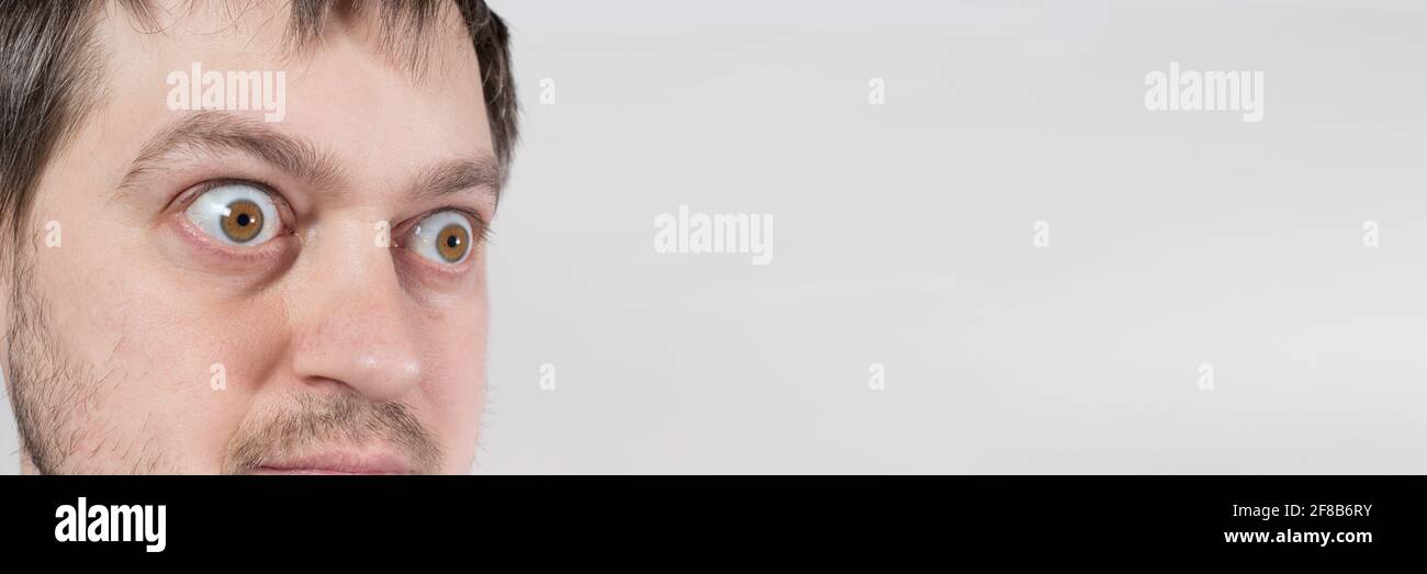 Ojos sorprendidos de un hombre bandera para el texto. Grandes ojos abultados. Para anunciar descuentos, ventas, tiendas de empeño o crédito. Foto de stock