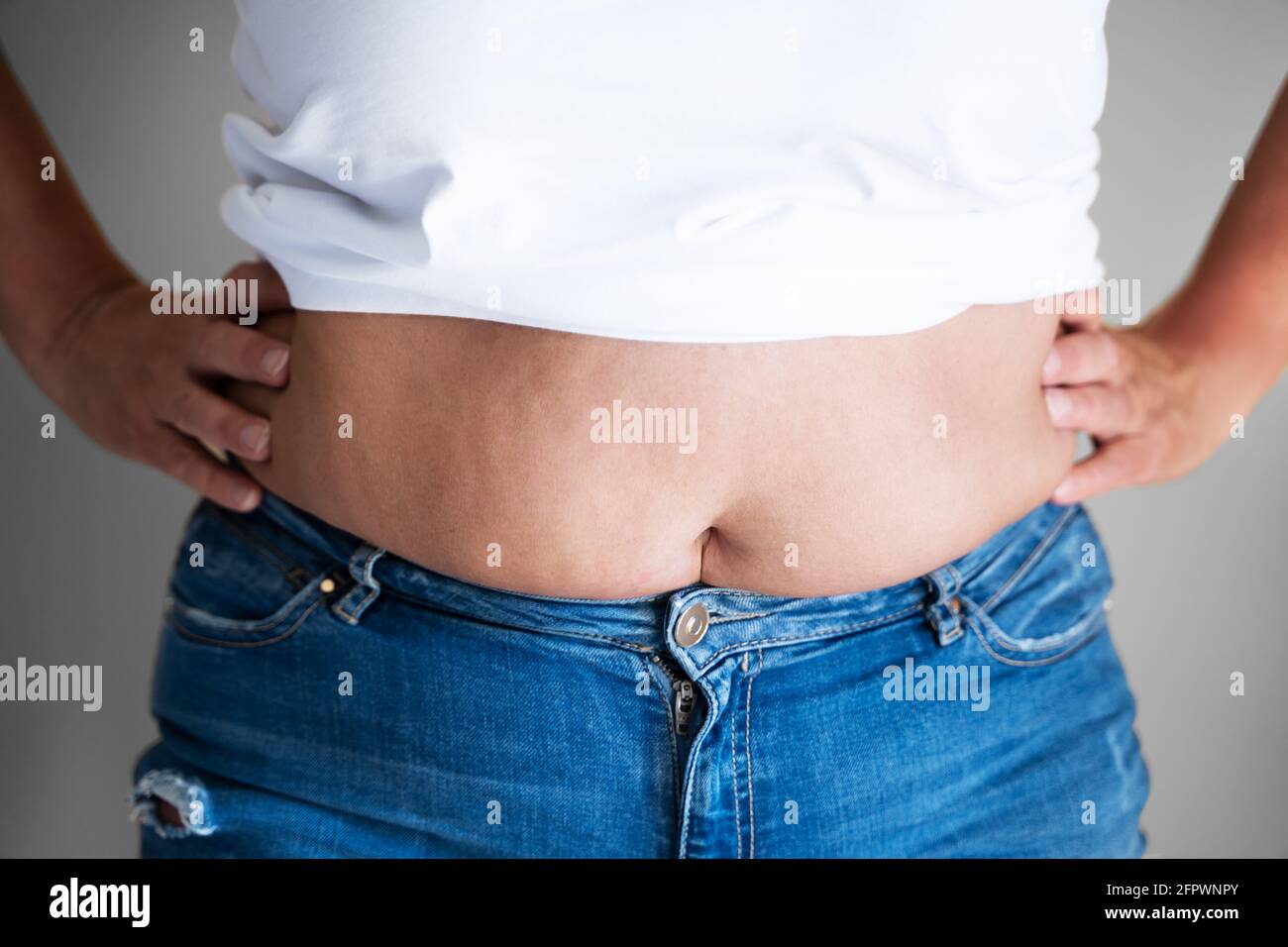 El botón del vientre de la mujer gorda y el cuerpo en dieta Foto de stock