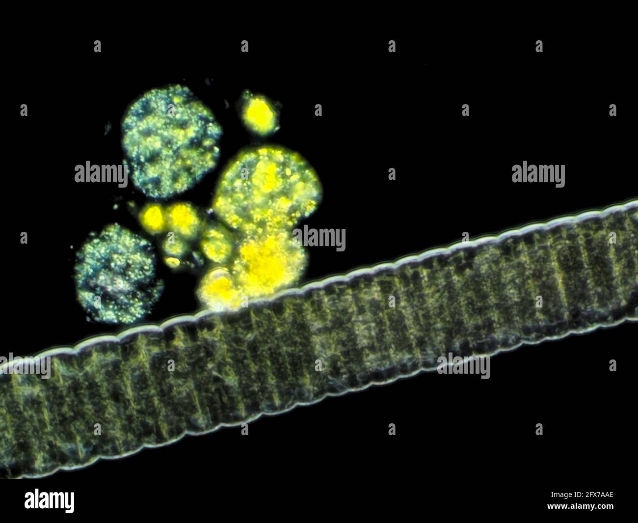 Fotomicrografía de campo oscuro de algas de agua dulce, el campo de visión horizontal es de unos 121 micrómetros Foto de stock