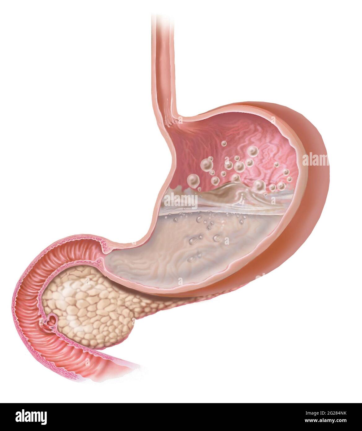 Lista 95+ Foto Dolor De Estomago Nauseas Y Gases Cena Hermosa