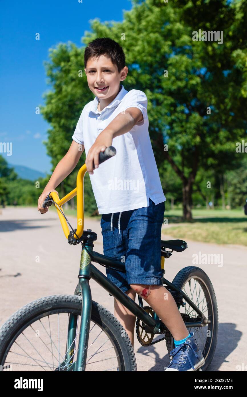 Niño usando pantalones cortos en bicicleta con raya manchada de sangre en  la rodilla Fotografía de stock - Alamy