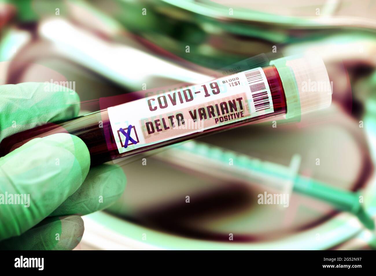 Tubo de análisis de sangre, variante delta B.1.617.2 Foto de stock