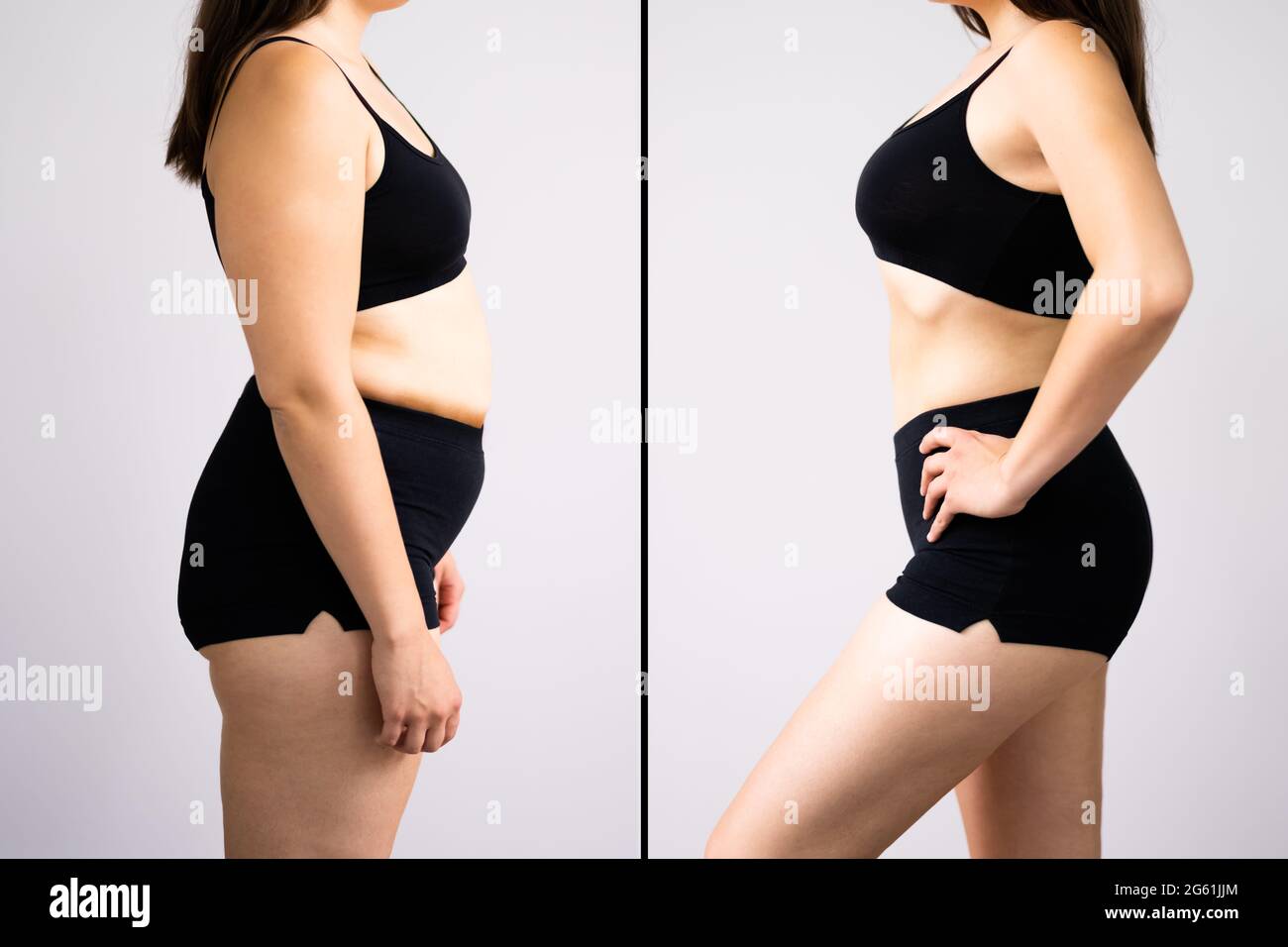 Mujer antes y después de la pérdida de peso sobre fondo gris. La forma del cuerpo se alteró durante el retoque Foto de stock