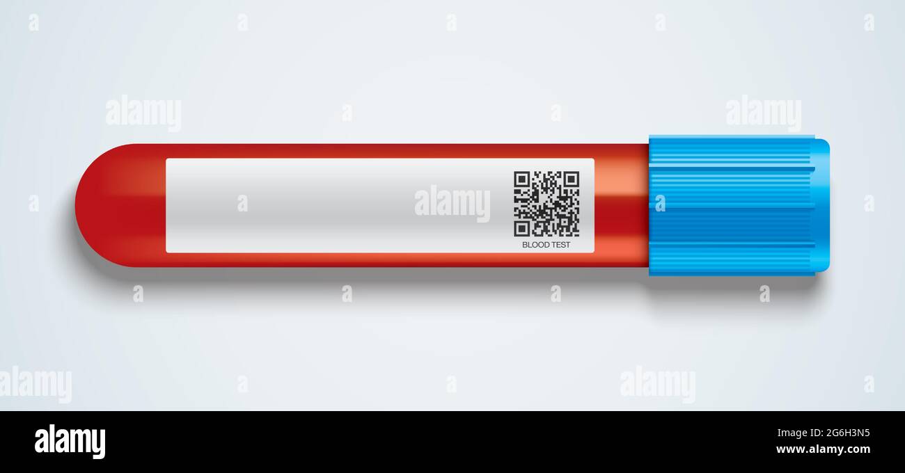 Tubo de vidrio para análisis de sangre con una etiqueta de información en blanco. Ilustración del Vector