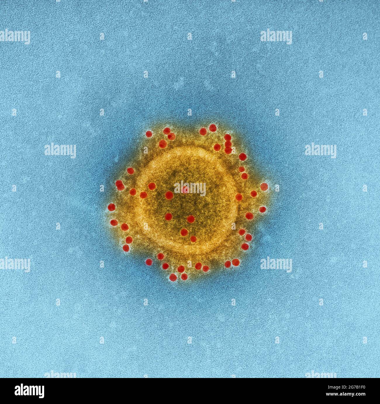 Imagen del virión 'coronavirus del síndrome respiratorio de Oriente Medio' (MERS-CoV) producido por el Instituto Nacional de Alergias y Enfermedades Infecciosas de los Estados Unidos (NIAID), esta imagen de transmisión microscópica de electrones (TEM), altamente ampliada y coloreada digitalmente, resalta la envoltura de partículas de una sola, Virión MERS-CoV en forma esférica Una versión optimizada y mejorada de una imagen producida por el Instituto Nacional de Alergias y Enfermedades Infecciosas de los Estados Unidos / Crédito: NIAID Foto de stock