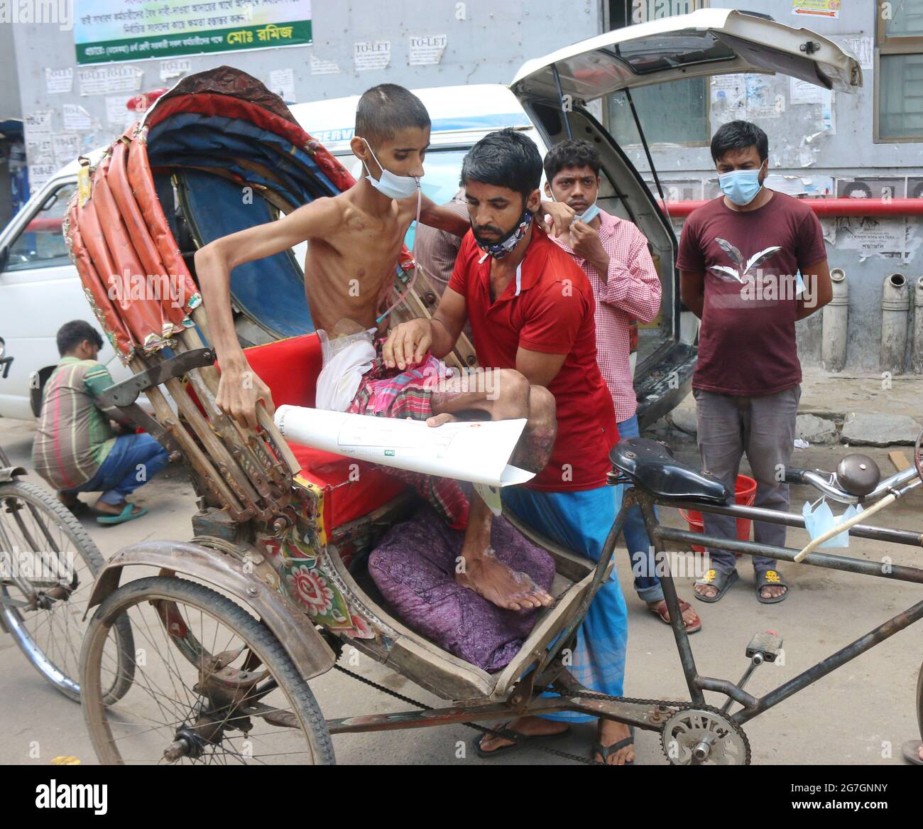 Julio de 14,2021. Dhaka, Bangladesh: Saiful Islam, edad 14 años. Fue admitido en la unidad de quemaduras del Hospital Médico de Dhaka durante tres meses y veinte días Foto de stock