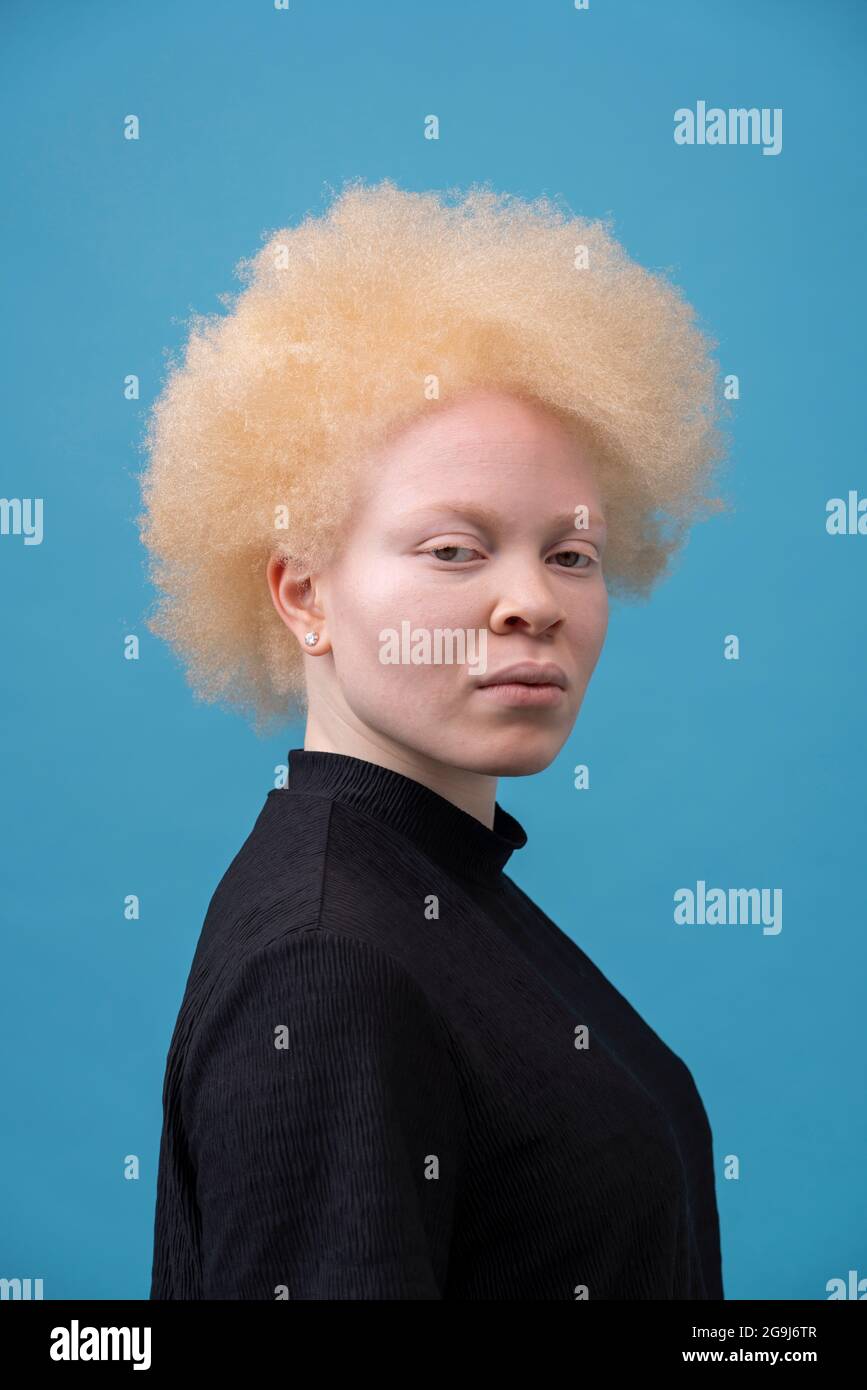 Estudio retrato de mujer albino Foto de stock