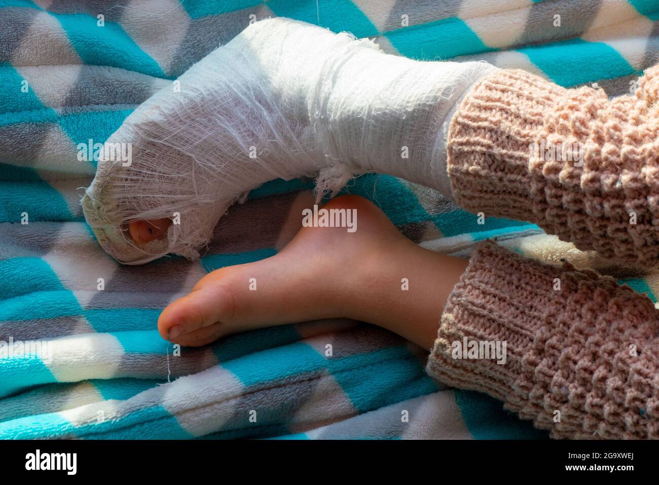 Niño con venda en la fractura del talón de la pierna. Pie derecho roto, hueso, pantorrilla, tobillo, pierna en yeso, férula de niño. Pequeño boi durmiendo en una blanke azul Foto de stock