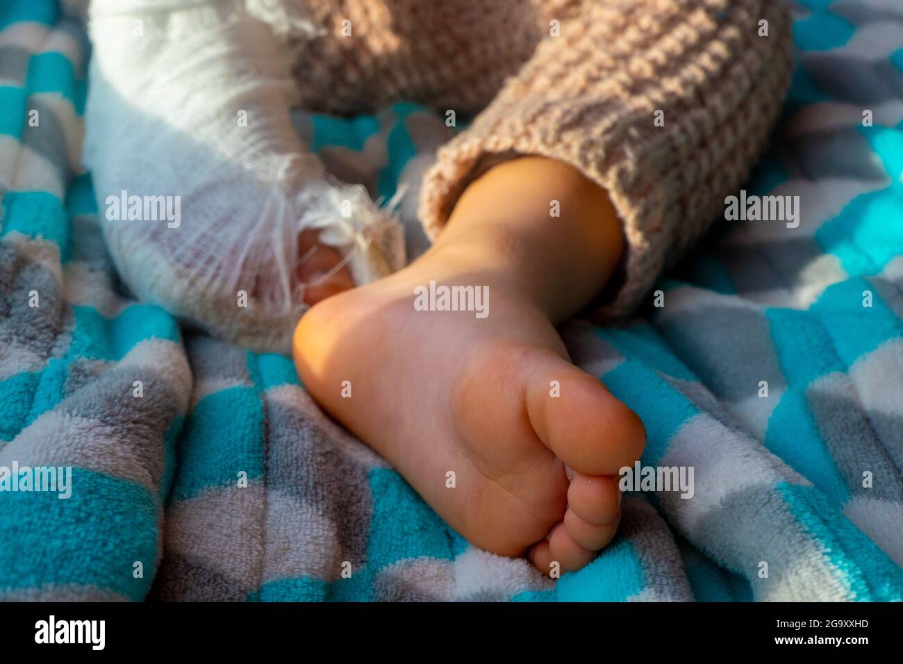 Niño con venda en la fractura del talón de la pierna. Pie derecho roto, hueso, pantorrilla, tobillo, pierna en yeso, férula de niño. Pequeño boi durmiendo en una blanke azul Foto de stock