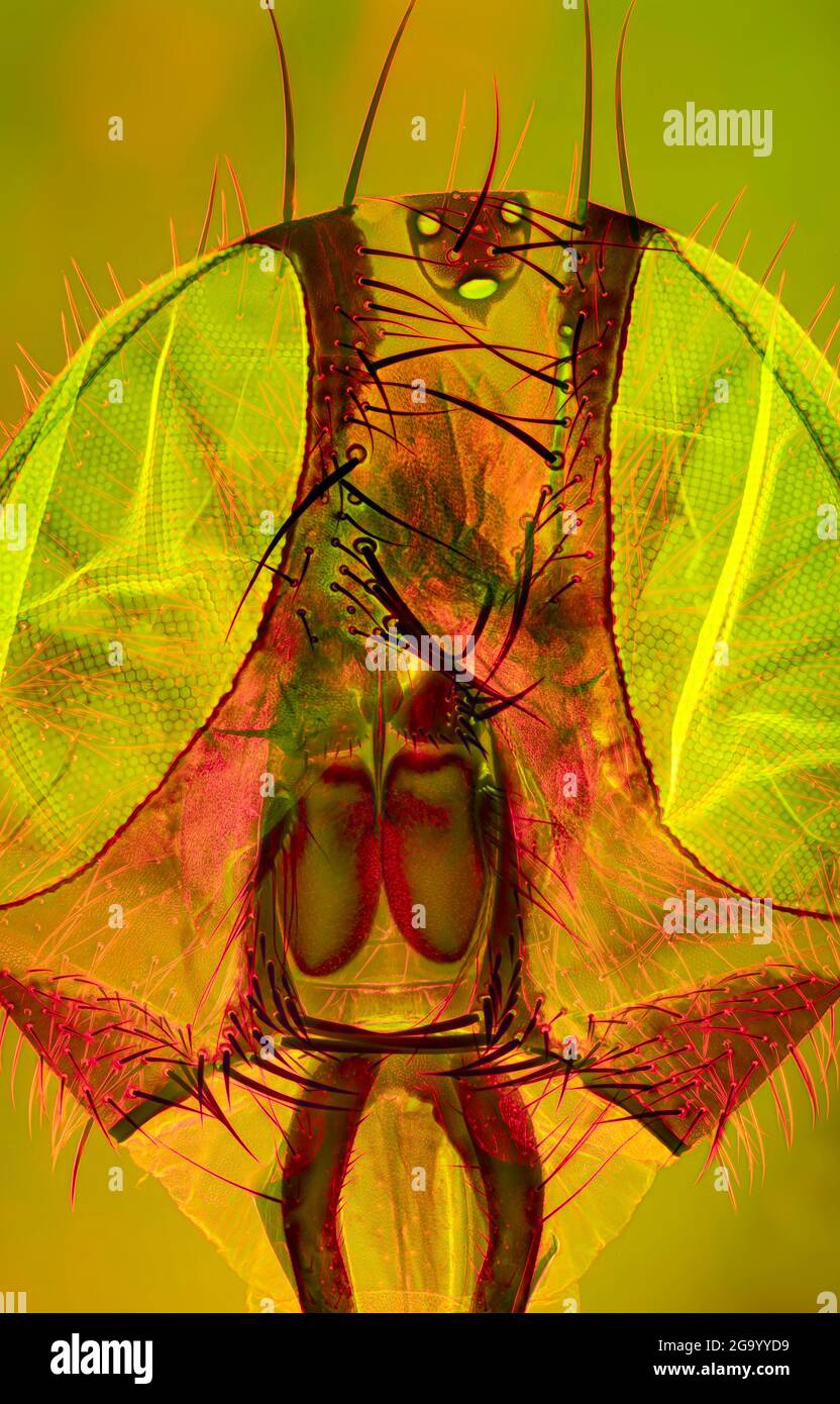 Mosca doméstica (Musca domestica), cabeza de una mosca doméstica, campo oscuro y RMI de contraste de fase Foto de stock