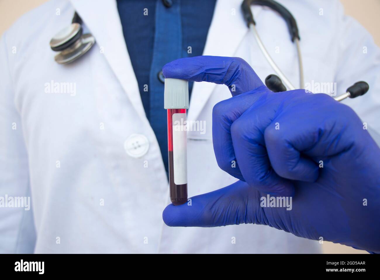 El médico sostiene la sangre en el tubo de ensayo Foto de stock